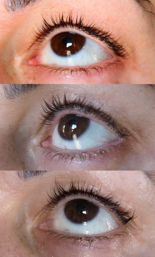 The Ordinary Multi-Peptide Lash and Brow Serum Review Before and After 1 Month and 6 weeks