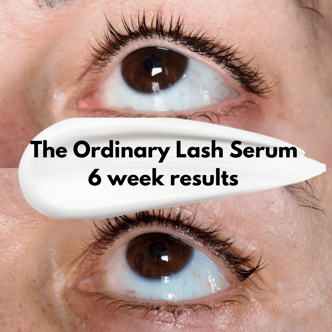 The Ordinary Multi-Peptide Lash and Brow Serum Review and Before and After Pics